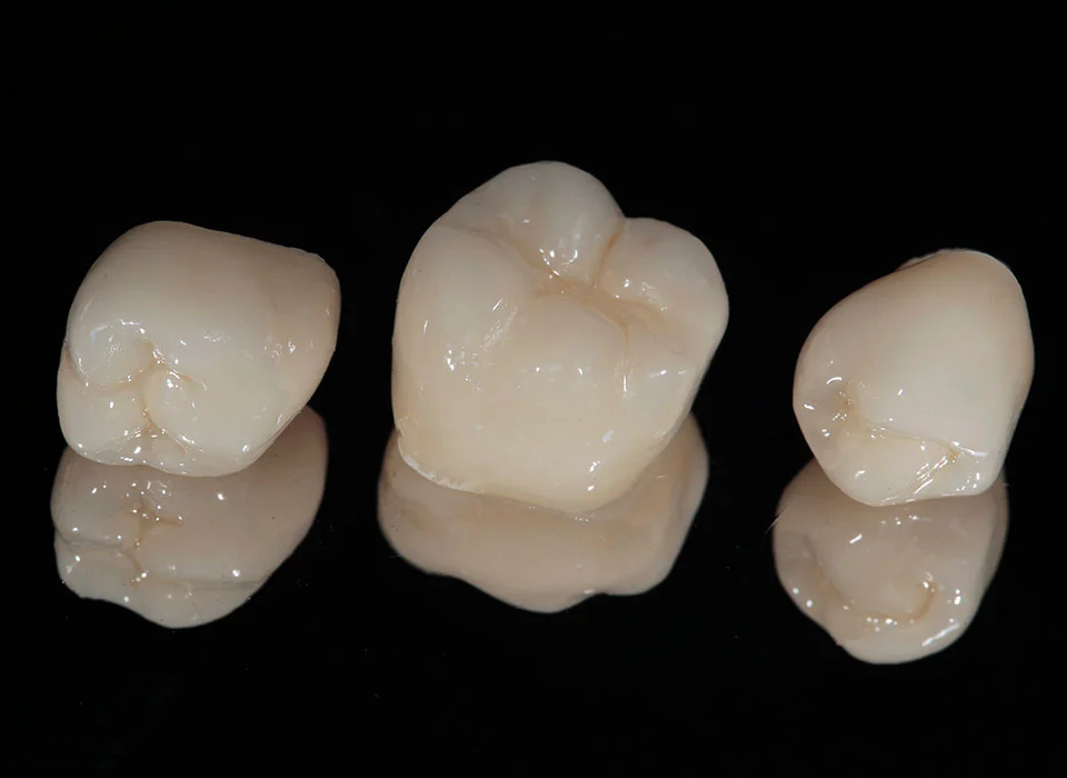 Dental crowns on a black reflective table - Dental Crowns in Beverly Hills, Ca